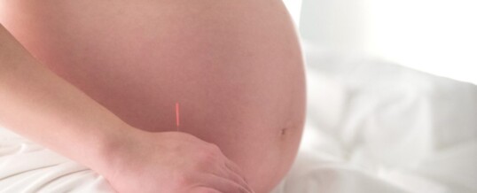 The Benefits of Prenatal Acupuncture